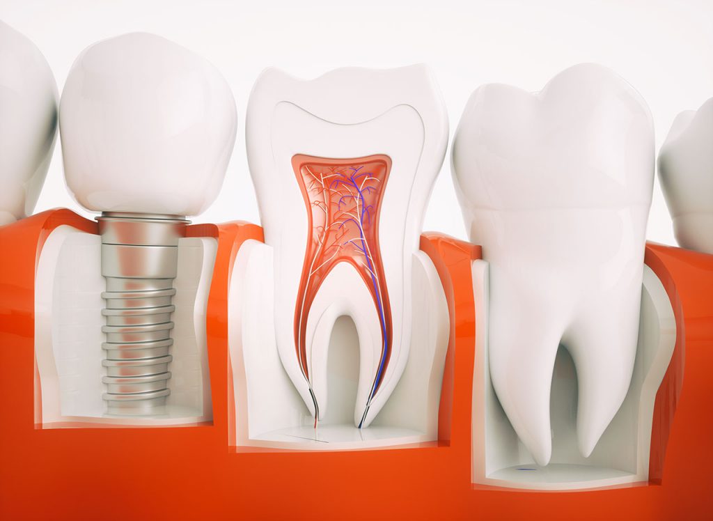 Dentale Dienstleistungen aus dem zahntechnischen Labor.