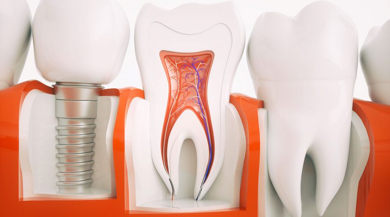 Dentale Dienstleistungen aus dem zahntechnischen Labor.